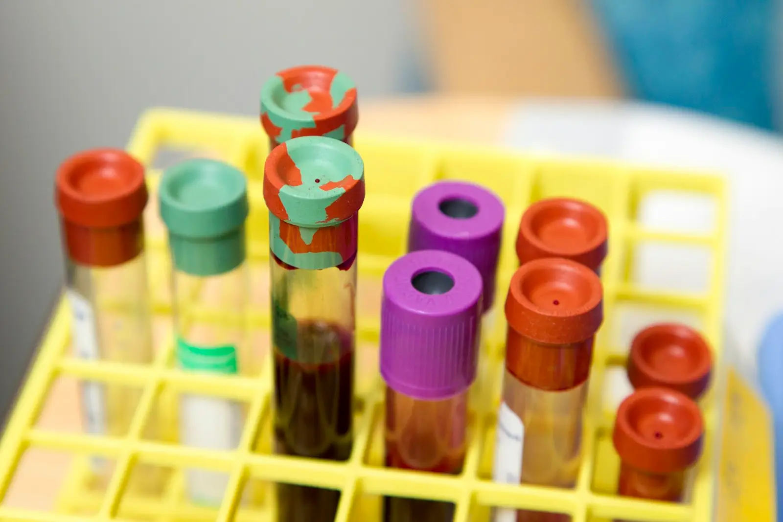 Rack of laboratory sample tubes